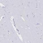 MYO1F Antibody in Immunohistochemistry (IHC)