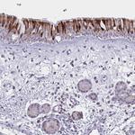 VWC2 Polyclonal Antibody