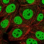 HYPK Antibody in Immunocytochemistry (ICC/IF)