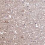 HYPK Antibody in Immunohistochemistry (Paraffin) (IHC (P))