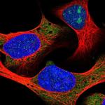 RPL18A Polyclonal Antibody