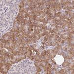 RPL18A Antibody in Immunohistochemistry (Paraffin) (IHC (P))