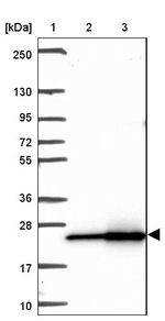 RPL18A Antibody in Western Blot (WB)