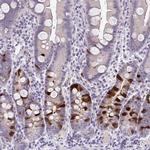 Cdc20 Antibody in Immunohistochemistry (IHC)