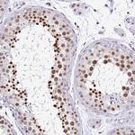DR1 Antibody in Immunohistochemistry (Paraffin) (IHC (P))
