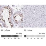 DR1 Antibody in Immunohistochemistry (IHC)