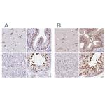 DR1 Antibody in Immunohistochemistry (IHC)