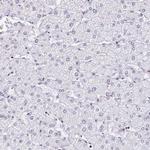 DR1 Antibody in Immunohistochemistry (IHC)