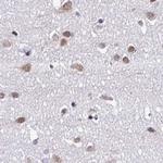 DR1 Antibody in Immunohistochemistry (IHC)