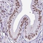 DR1 Antibody in Immunohistochemistry (IHC)