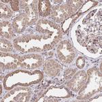 SAT1 Antibody in Immunohistochemistry (Paraffin) (IHC (P))