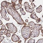 SAT1 Antibody in Immunohistochemistry (Paraffin) (IHC (P))
