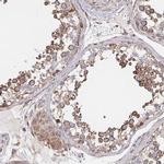 SAT1 Polyclonal Antibody