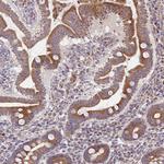 SAT1 Antibody in Immunohistochemistry (Paraffin) (IHC (P))