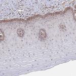 NEURL4 Polyclonal Antibody