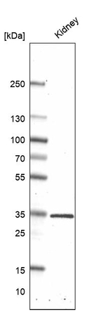 ATP6V0D2 Antibody in Western Blot (WB)