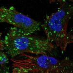 Tensin 3 Polyclonal Antibody