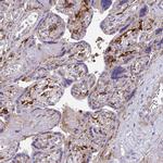 Tensin 3 Antibody in Immunohistochemistry (IHC)
