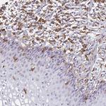 Tensin 3 Antibody in Immunohistochemistry (IHC)