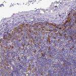 Tensin 3 Antibody in Immunohistochemistry (IHC)