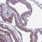 Tensin 3 Antibody in Immunohistochemistry (IHC)