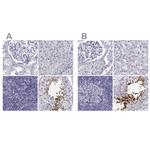CLPH Polyclonal Antibody