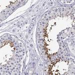 CLPH Antibody in Immunohistochemistry (IHC)
