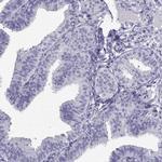 CLPH Antibody in Immunohistochemistry (IHC)