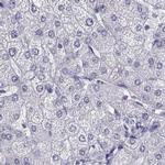 CLPH Antibody in Immunohistochemistry (IHC)