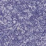 CLPH Antibody in Immunohistochemistry (IHC)