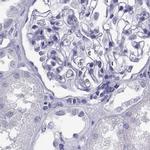 CLPH Antibody in Immunohistochemistry (IHC)