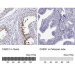 CLPH Antibody