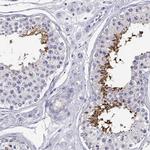 CLPH Antibody in Immunohistochemistry (IHC)