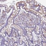 FIBCD1 Antibody in Immunohistochemistry (Paraffin) (IHC (P))