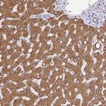 EML5 Polyclonal Antibody