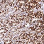 ZNF256 Antibody in Immunohistochemistry (Paraffin) (IHC (P))