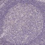 ZNF214 Antibody in Immunohistochemistry (Paraffin) (IHC (P))