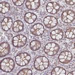 ZNF214 Antibody in Immunohistochemistry (Paraffin) (IHC (P))