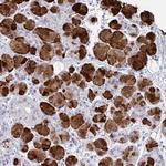 ZNF214 Polyclonal Antibody