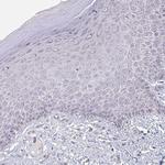ZNF214 Antibody in Immunohistochemistry (Paraffin) (IHC (P))