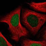 UPP1 Polyclonal Antibody