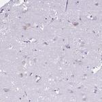 SIA7C Antibody in Immunohistochemistry (Paraffin) (IHC (P))