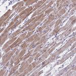 SIA7C Antibody in Immunohistochemistry (Paraffin) (IHC (P))