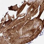 SIA7C Antibody in Immunohistochemistry (Paraffin) (IHC (P))