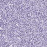 SIA7C Antibody in Immunohistochemistry (Paraffin) (IHC (P))