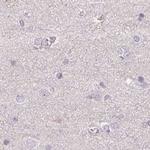 ALDH8A1 Antibody in Immunohistochemistry (IHC)