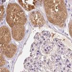 ALDH8A1 Antibody in Immunohistochemistry (IHC)