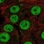 SYT10 Polyclonal Antibody