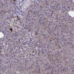 SYT10 Antibody in Immunohistochemistry (Paraffin) (IHC (P))