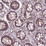 ZNF555 Polyclonal Antibody